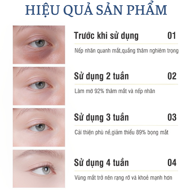 Thanh Lăn Giảm Quầng Thâm Bọng Mắt Bioaqua (15ml)