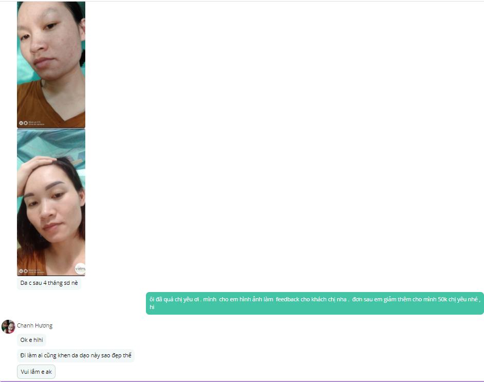 Combo 2 chai Serum Mụn Lộc Đề H 30ml - Peel Acnes Blanc H
