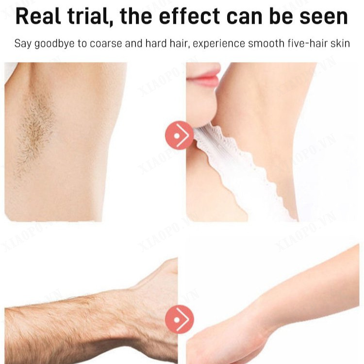 xiaopo Blu-ray induction painless hair removal device