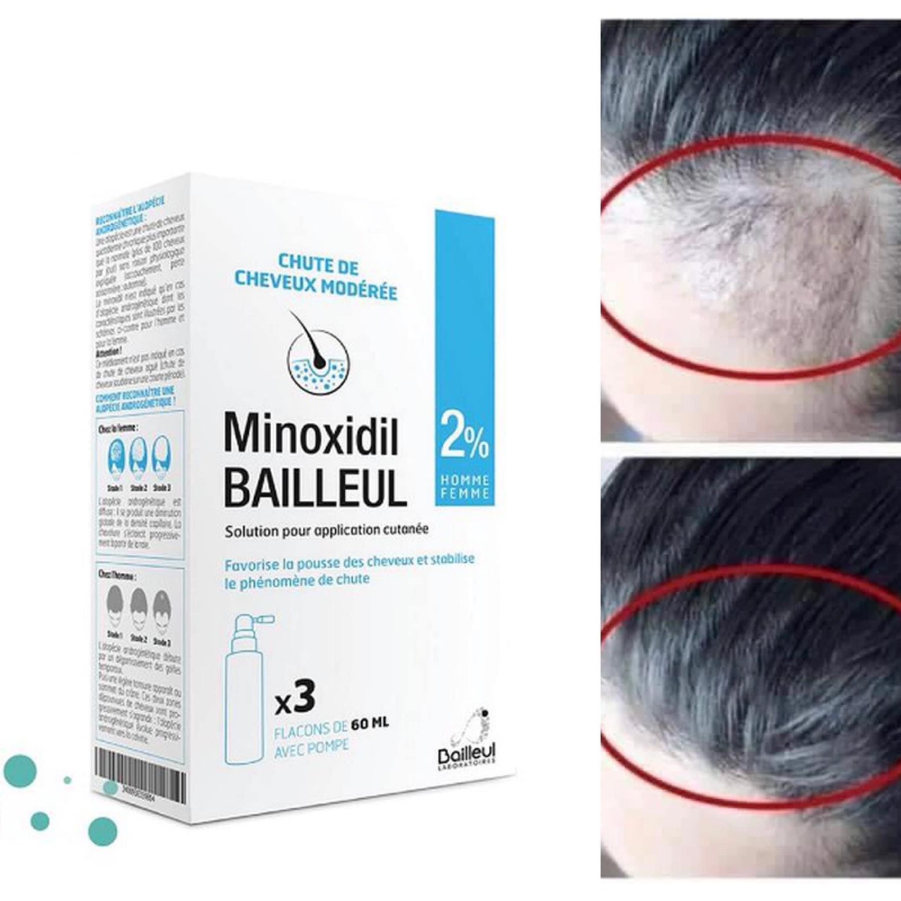 [GIẢM 5% ĐƠN 129K]Xịt mọc tóc Minoxidil Bailleul