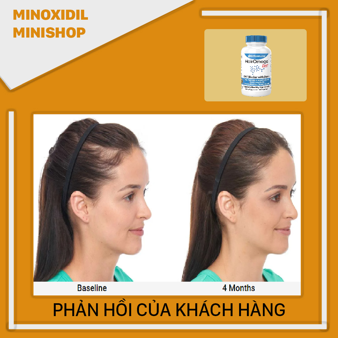 HairOmega DHT Blocker - Mọc Tóc Ngăn Rụng Tóc