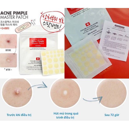 [HCM]Miếng Dán Xẹp Mụn Cấp Tốc Che Khuyết Điểm Cosrx Acne Pimple Master Patch (Gồm 24 miếng dán)