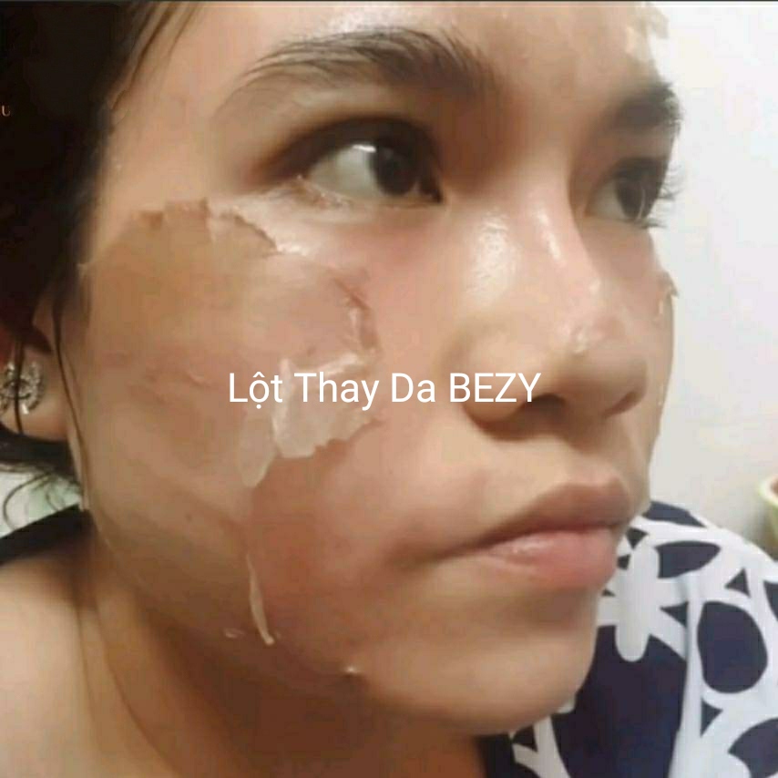 BEZY Lột Thay Trắng Da Mờ Thâm Nám Thái Lan