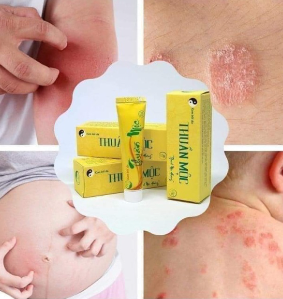 Kem bôi da Thuần mộc chính hãng