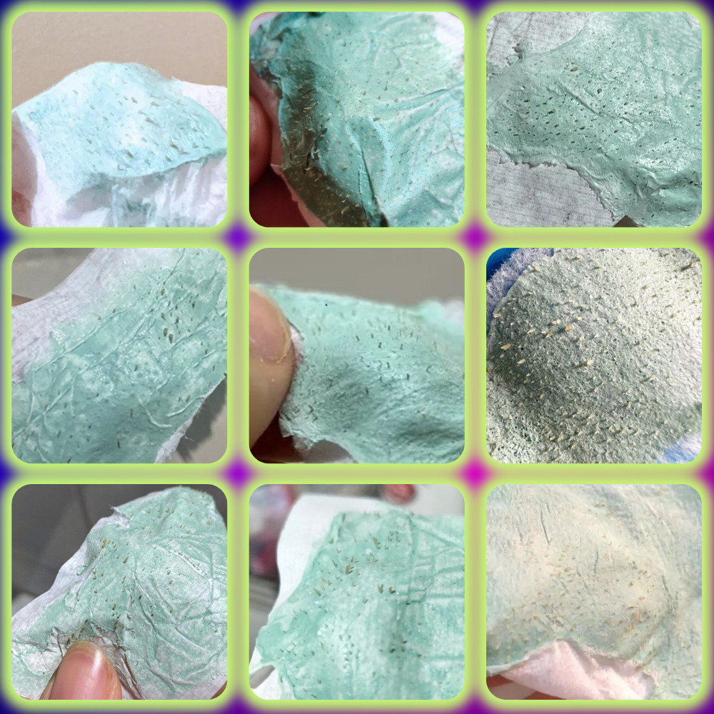 Gel lột mụn cám,mụn đầu đen Blackhead Mask, mặt nạ lột mụn không gây đau rát, kháng khuẩn, se khít lỗ chân lông tuýp 20g chính hãng Hanseoul