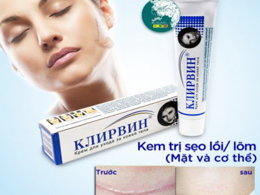 Kem mờ xóa sẹo Nga