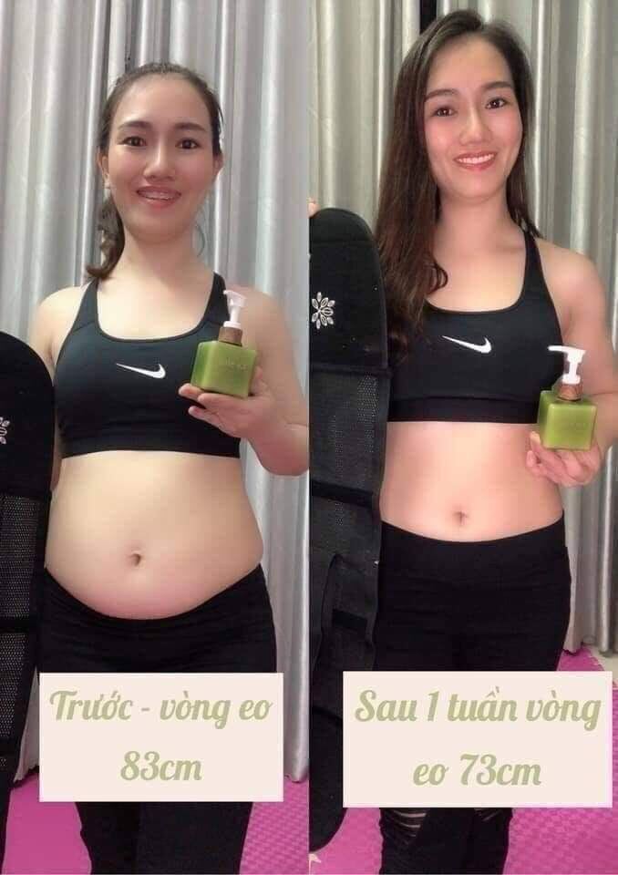 Kem tan mỡ bụng Go slim (tặng kèm nịt bụng)