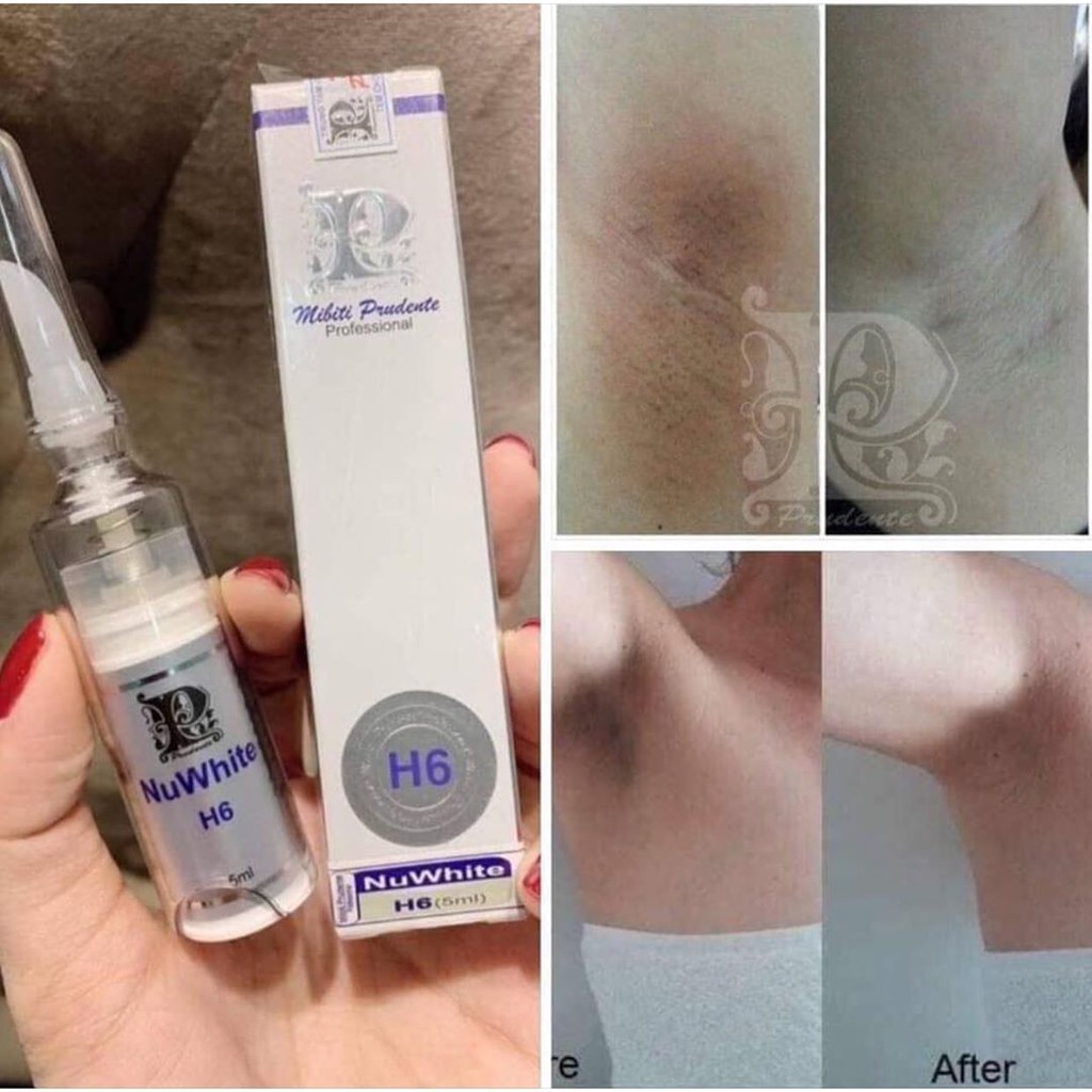 Kem trị thâm nám bẹn nách H6 Nuwhite
