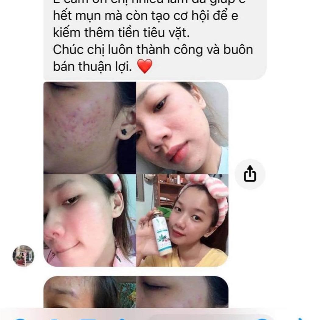 Combo 3 Chai thuoc bac tái tạo da hết mặt mụn lưng 2024 [125ML tặng kèm lọ giảm đỏ]