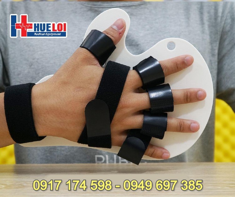 Nẹp cố định bàn tay