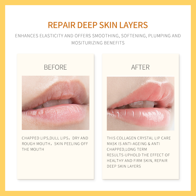 KIMJUSE Mặt nạ môi pha lê Collagen hồng