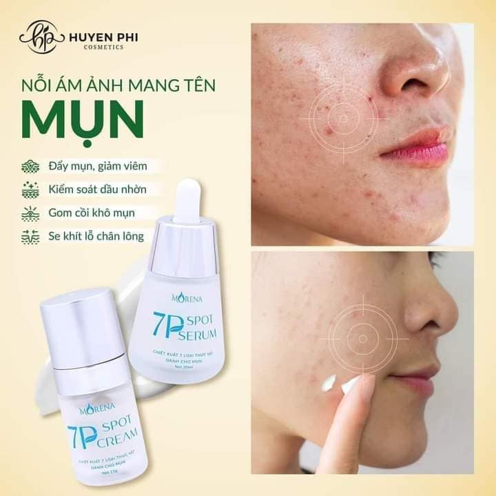 Serum mụn 7P Spot serum Huyền Phi