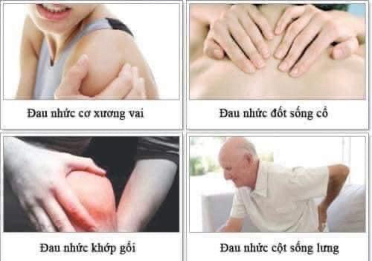 Kem ngừa nứt nẻ da tay khô Eucerin 75ML - Bill Pháp