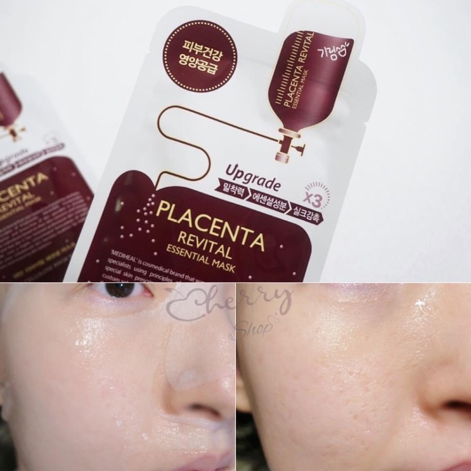 Mặt Nạ Giấy Mediheal Mask Ex