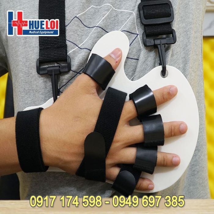 Nẹp cố định bàn tay