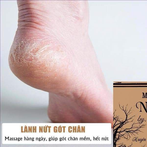 Mỡ Trăn N'store