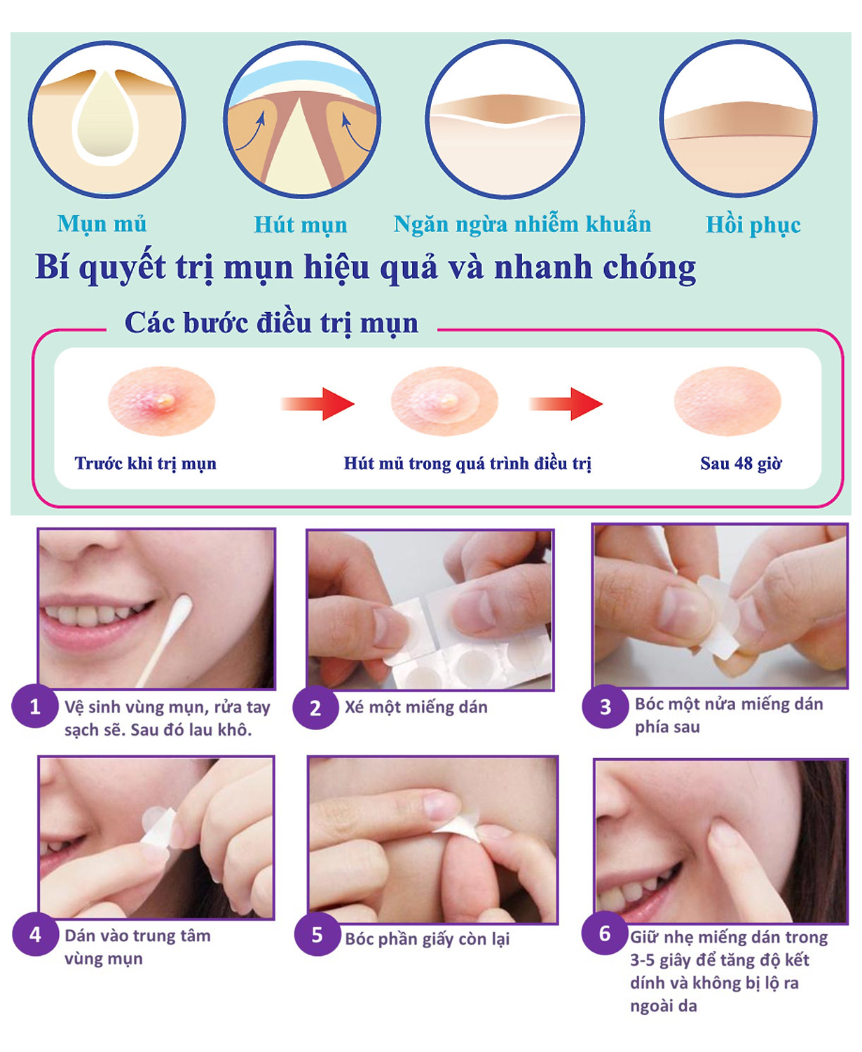 Miếng Dán Mụn Mayan Ultra Thin Spot 20+4 miếng (20 miếng 0.8cm + 04 miếng 1.0cm)