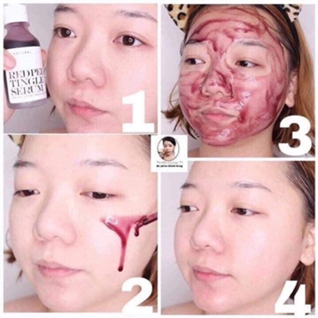Serum thay da sinh học SO NATURAL RED PEEL TINGLE