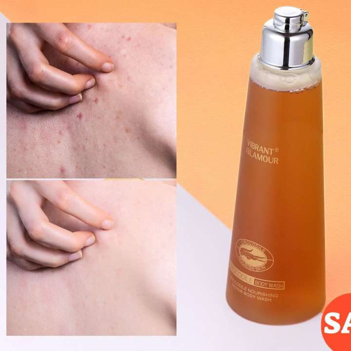 Sữa Tắm Hết Mụn, Hết Viên Da Lưng, Cánh Tay, Cơ Thể Làm Trắng Mịn Da VIBRANT GLAMOUR Dưỡng Ẩm Chăm Sóc Phục Hồi Da 200ml