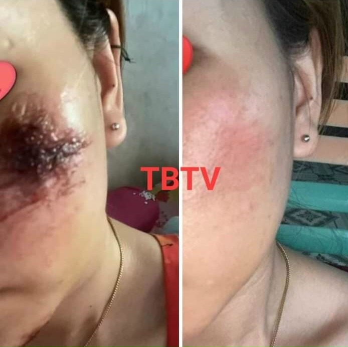 Tế bào gốc thực vật Trương Mai
