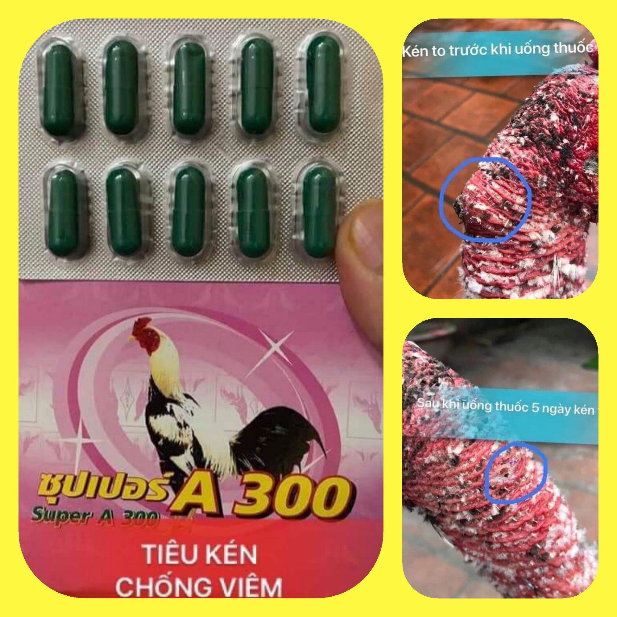Viêm Sưng Kén A300 - vỉ 10 viên