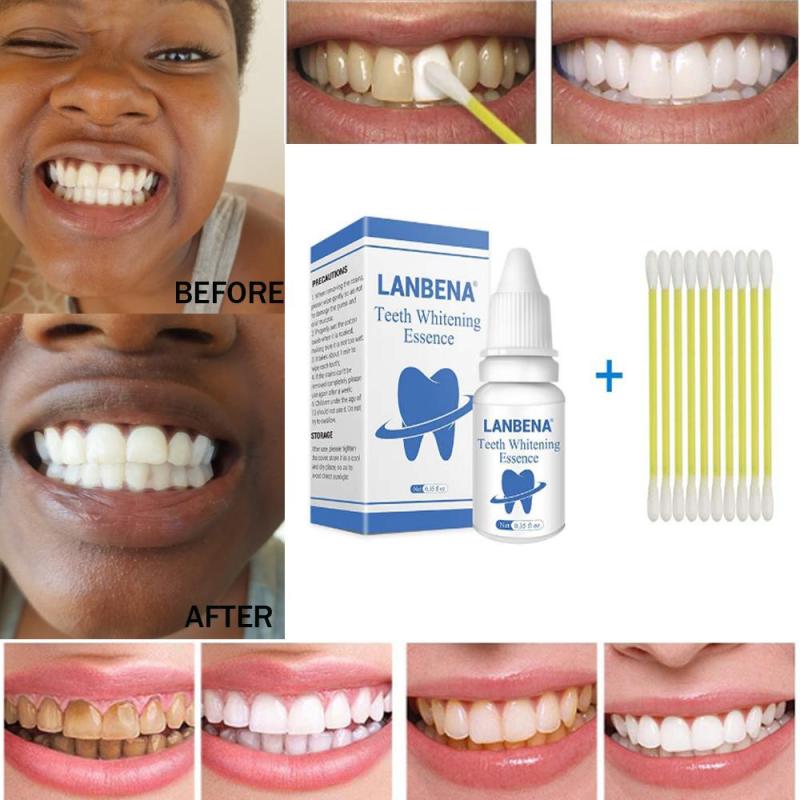 TRẮNG RĂNG Teeth clean spot cleaning LÀM SẠCH RĂNG teeth whitening  TRẮNG RĂNG teeth White Intensive Whitening Treatment nhập khẩu