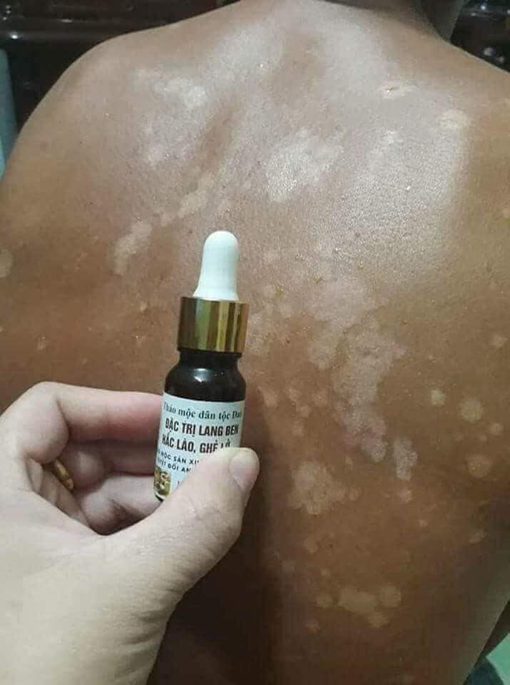 Lan Beng Trần Kim Huyền[Chính Hãng]
