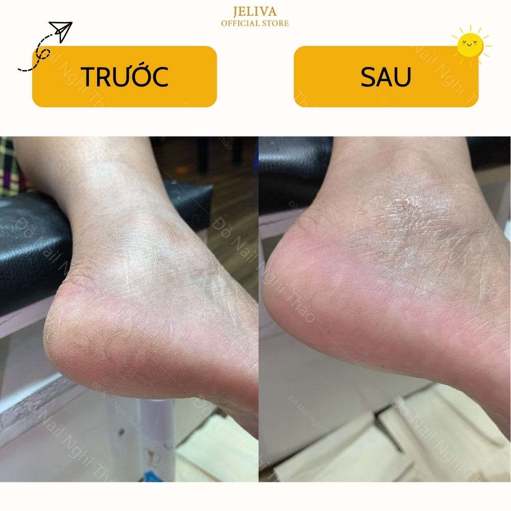Chai xịt mềm da chà gót Jeliva
