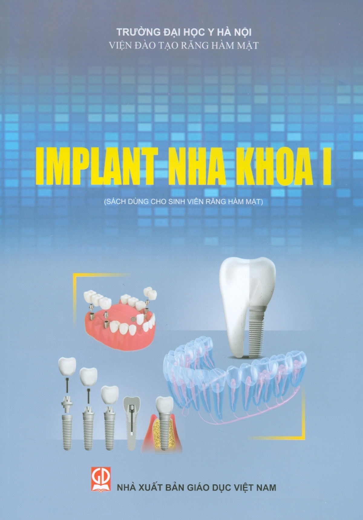 Sách - implant nha khoa i