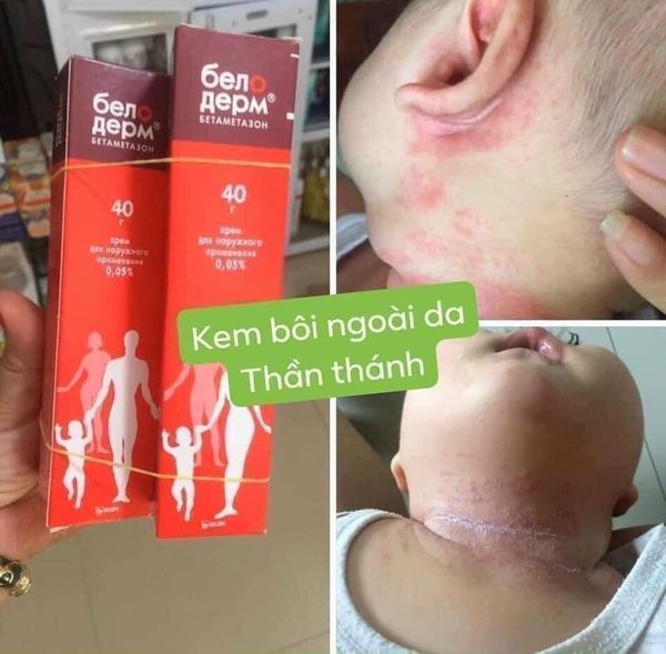 { HÀNG XÁCH TAY NGA CHÍNH HÃNG } - Kem bôi ngứa belosalic
