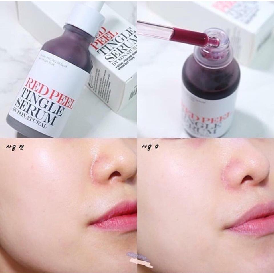 RED PEEL TINGLE SERUM 35ml