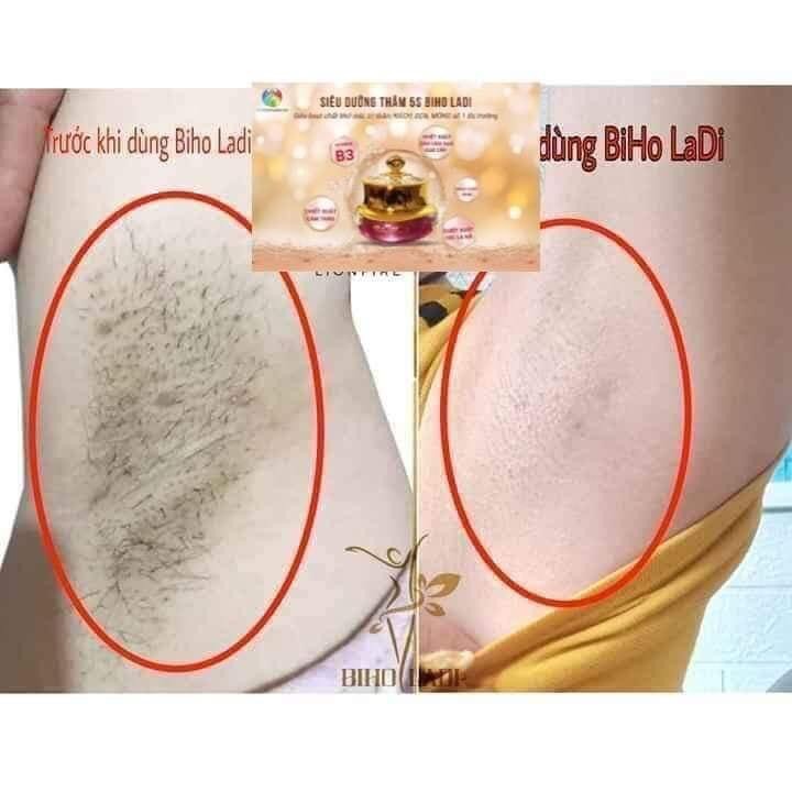 [HCM][HÀNG CHÍNH HÃNG] Kem Siêu Dưỡng Thâm 5S Biho Ladi