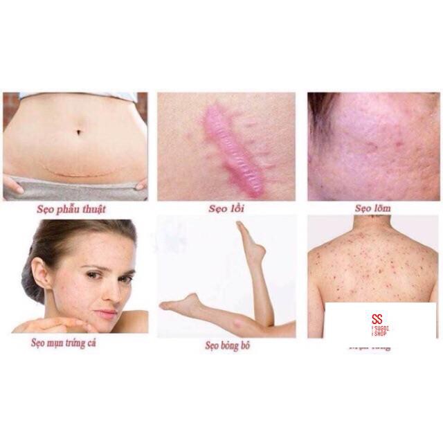 Kem làm mờ sẹo Gentacin Nhật Bản 10gr