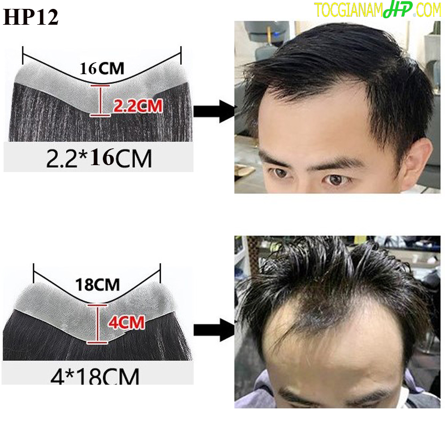 Tóc giả mái chữ M siêu da đầu che trán cao