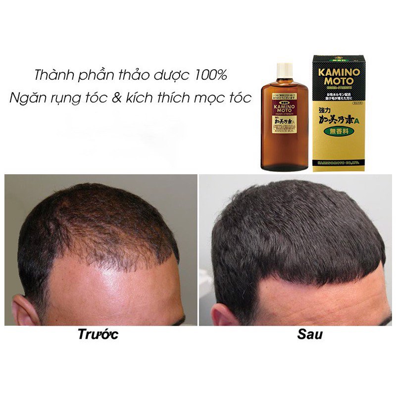 TINH DẦU KÍCH THÍCH MỌC TÓC KAMINOMOTO NHẬT BẢN