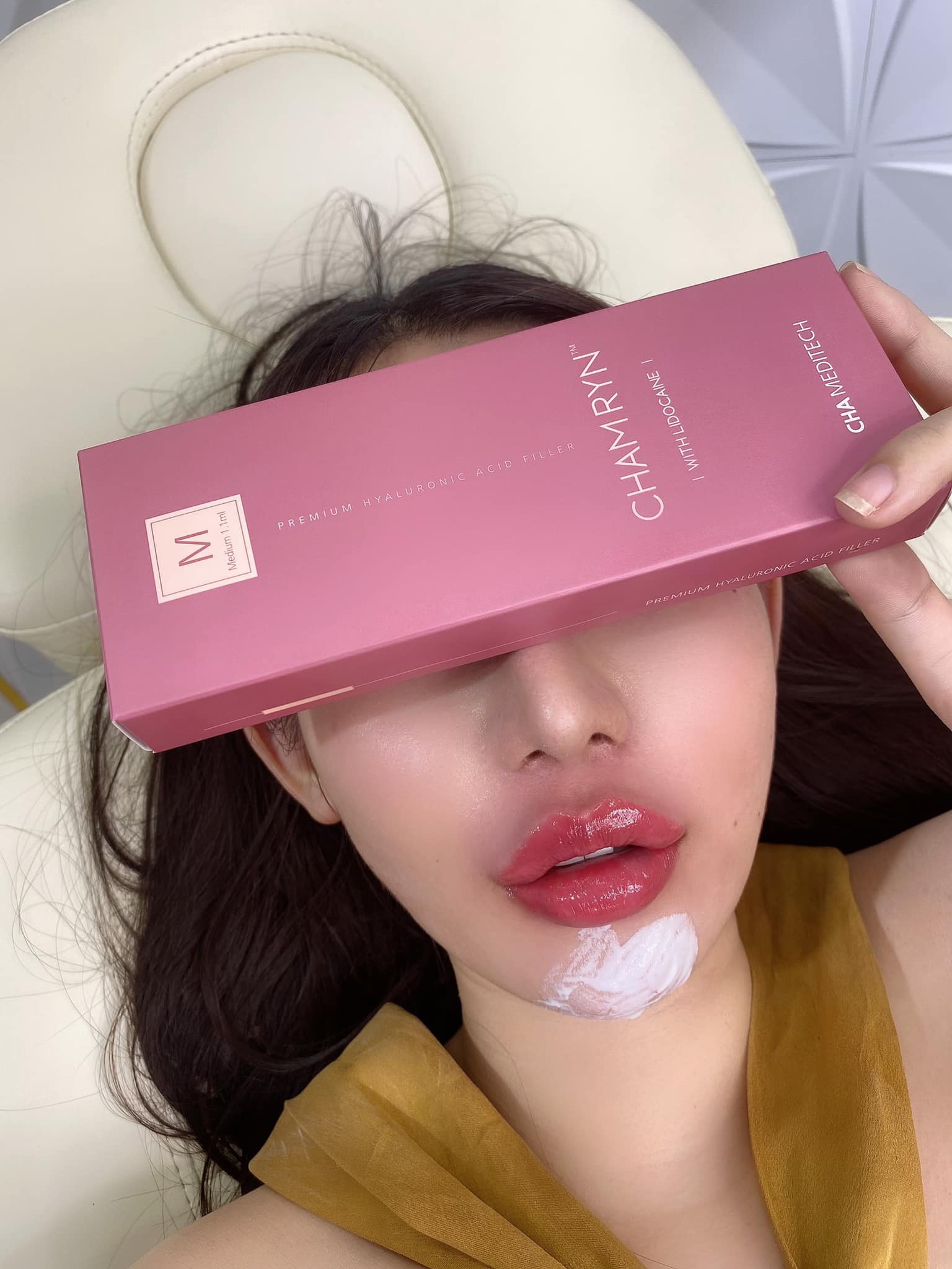 FILLER CHAMRYN HÀN QUỐC 1 HỘP 1CC