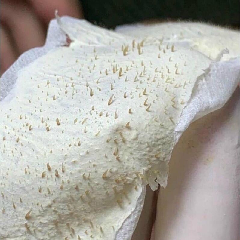 Kem lột mụn cám, mụn đầu đen PEELING PACK