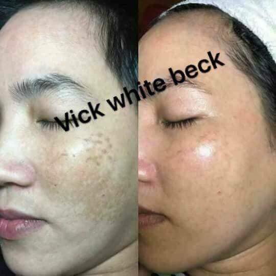 Kem Nám Trắng Da Vick White Beck
