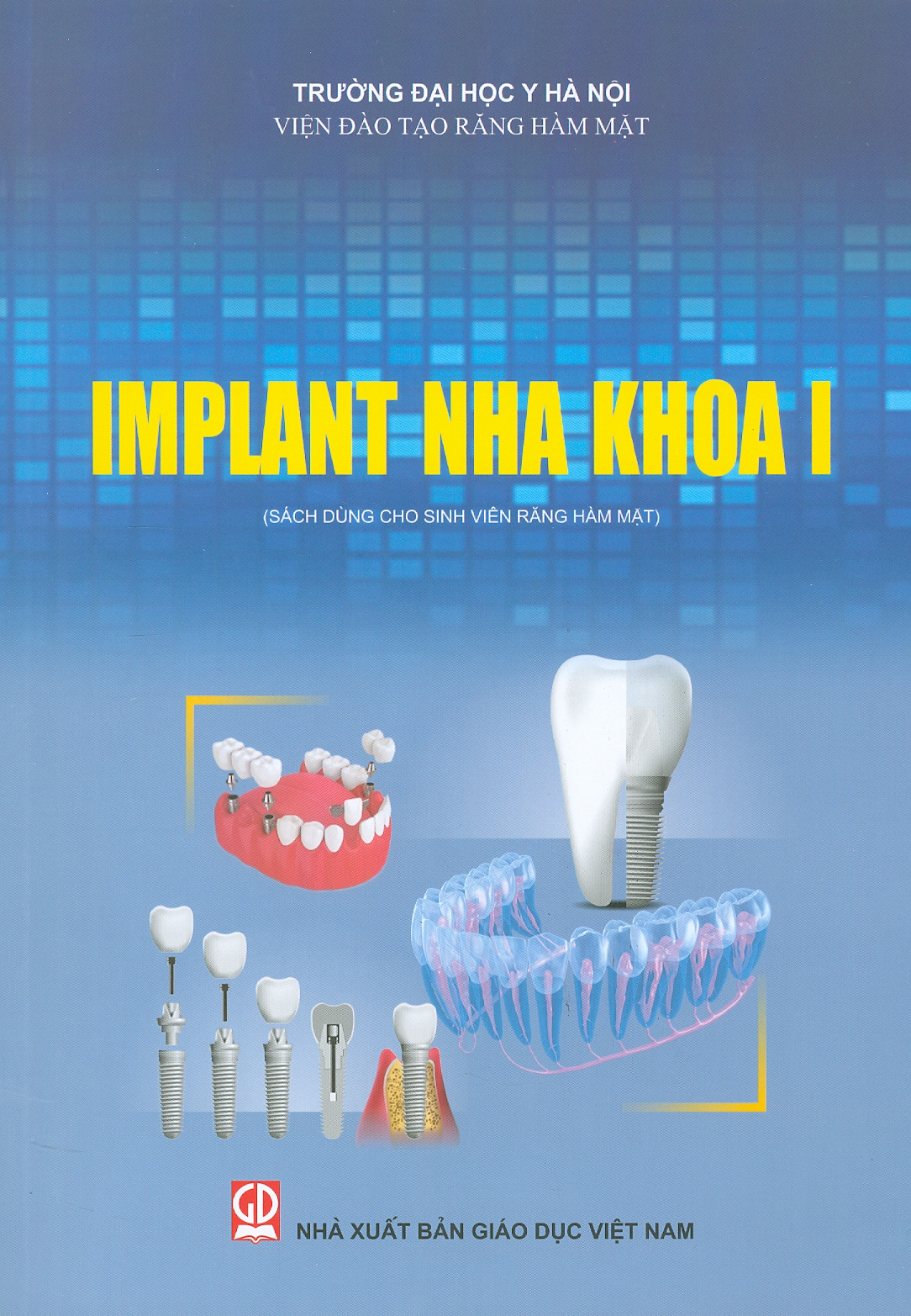 Implant Nha Khoa I (Sách Dùng Cho Sinh Viên Răng Hàm Mặt)