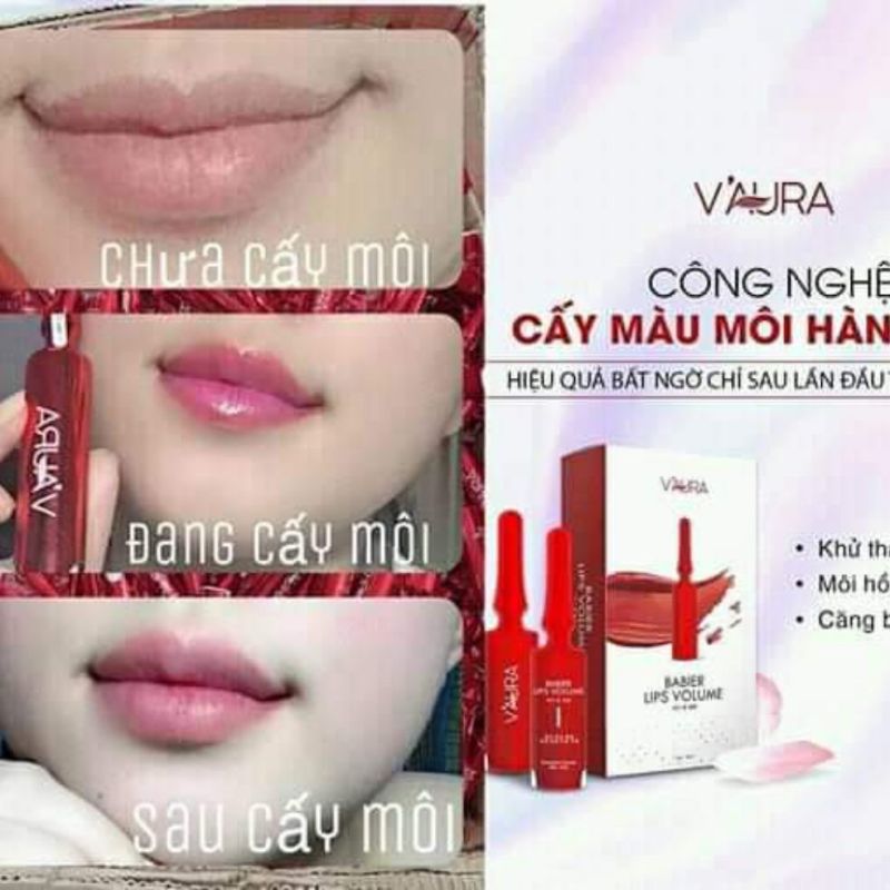 Tinh Chất BaBier Lips Volum Xóa Thâm Môi, làm hồng Môi, thay phin xăm