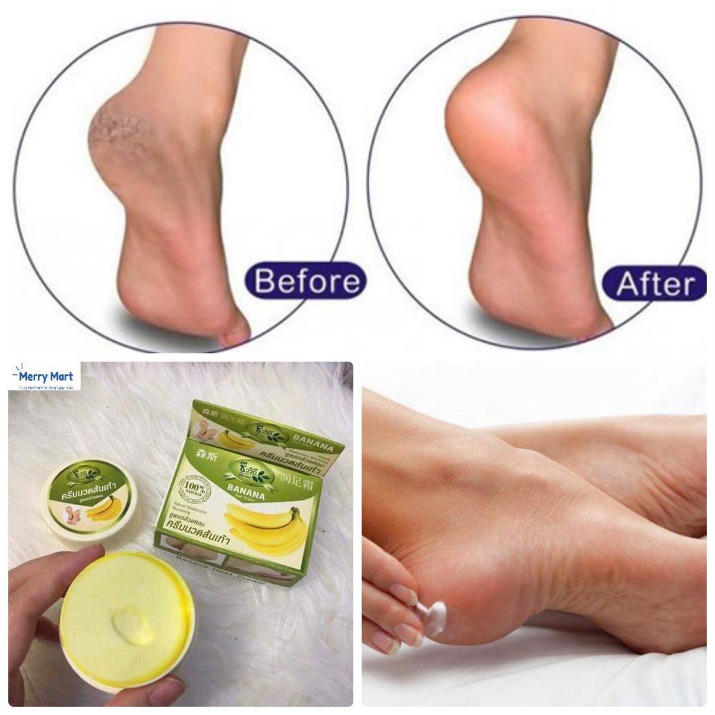 [HCM]Kem tri nứt gót chân Banana Heel Cream