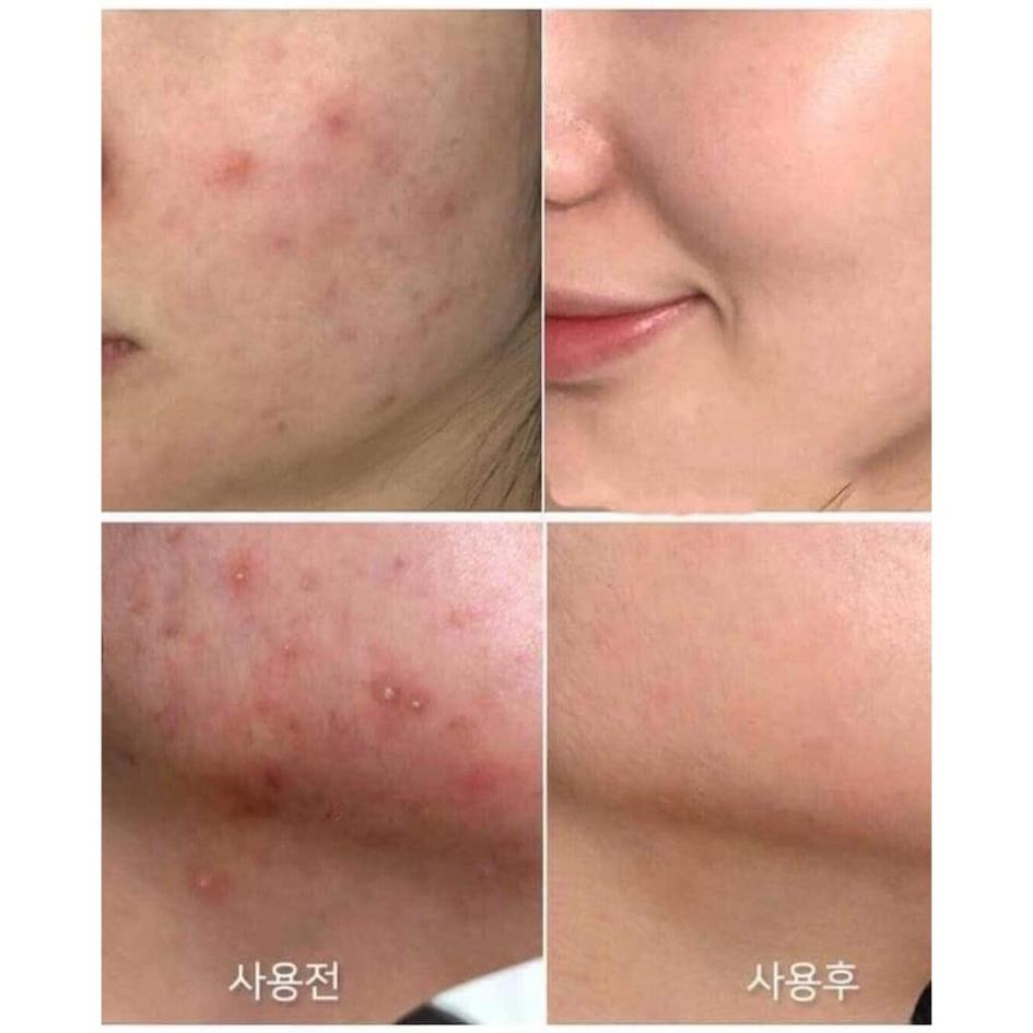 Sữa Rửa Mặt Cho Da Mụn Some By Mi AHA-BHA-PHA 30 Days Miracel