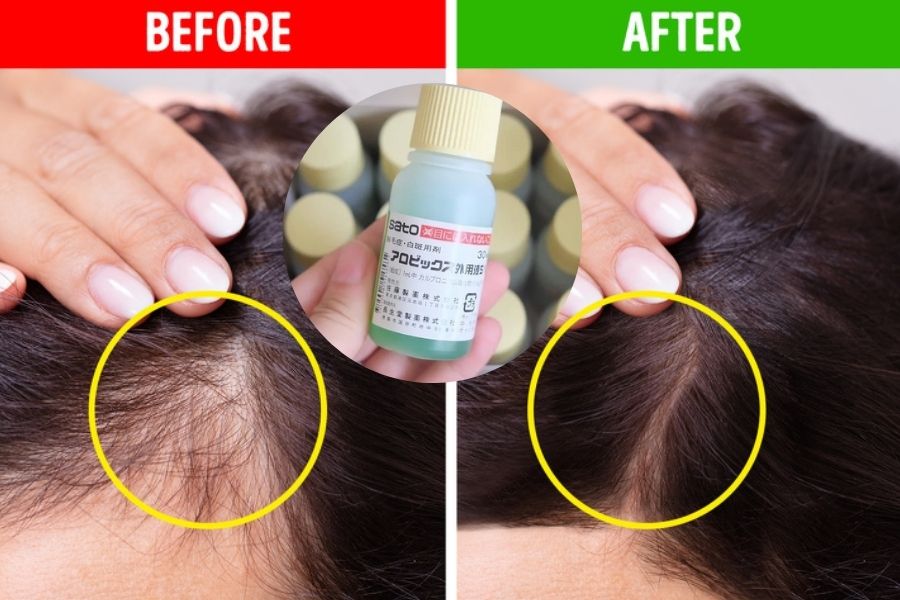 [Chính hãng] Tinh chất Mọc Tóc SATO Arovics Solutions 5% Nhật Bản 30ml