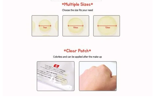 Miếng dán mụn Ciracle Red Spot Acne Pimple Path 24 Miếng