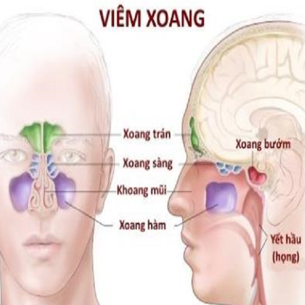 Thuốc Chữa Viêm Xoang Nam Hoàng
