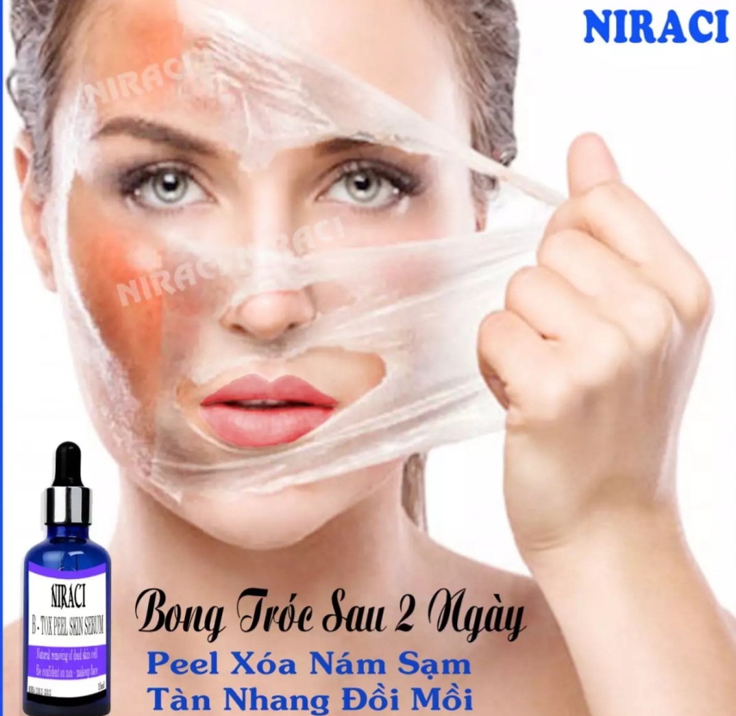 Feel Thay da Xóa Nám Niraci của Hàn Quốc