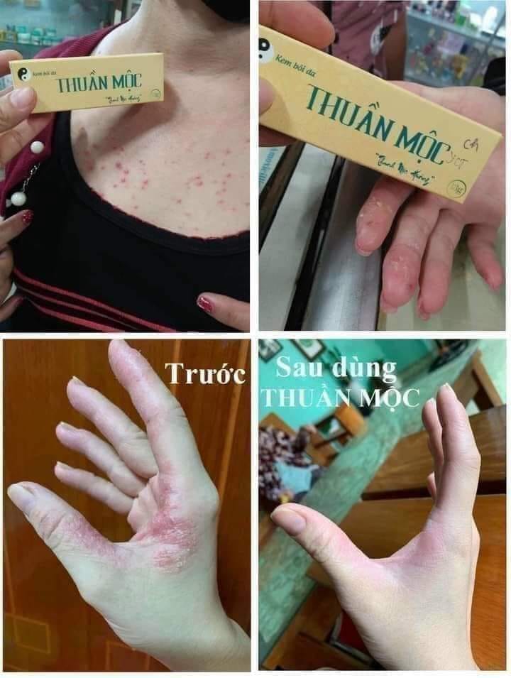 THUẦN MỘC - Thanh mộc hương