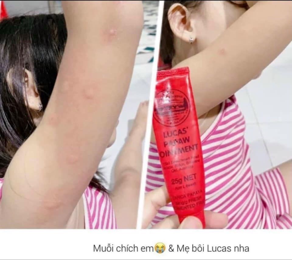 Kem đu đủ Lucas’ Papaw Ointment 25g ( Hàng Úc đi air)