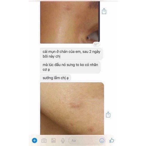 Kem Chấm Mụn,Kem Xẹp Mụn Clinda_m Thái Lan