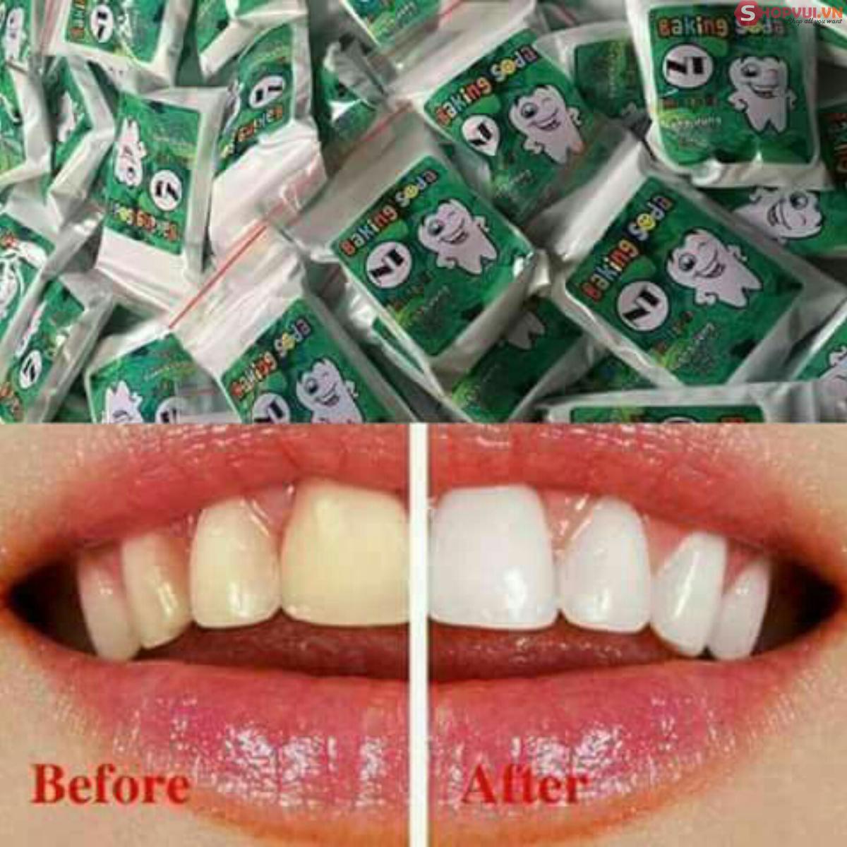 [HCM]Bột Làm Trắng Răng Baking Soda Mix Bạc Hà